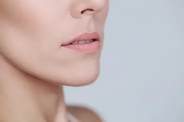 Remove Lip Lines