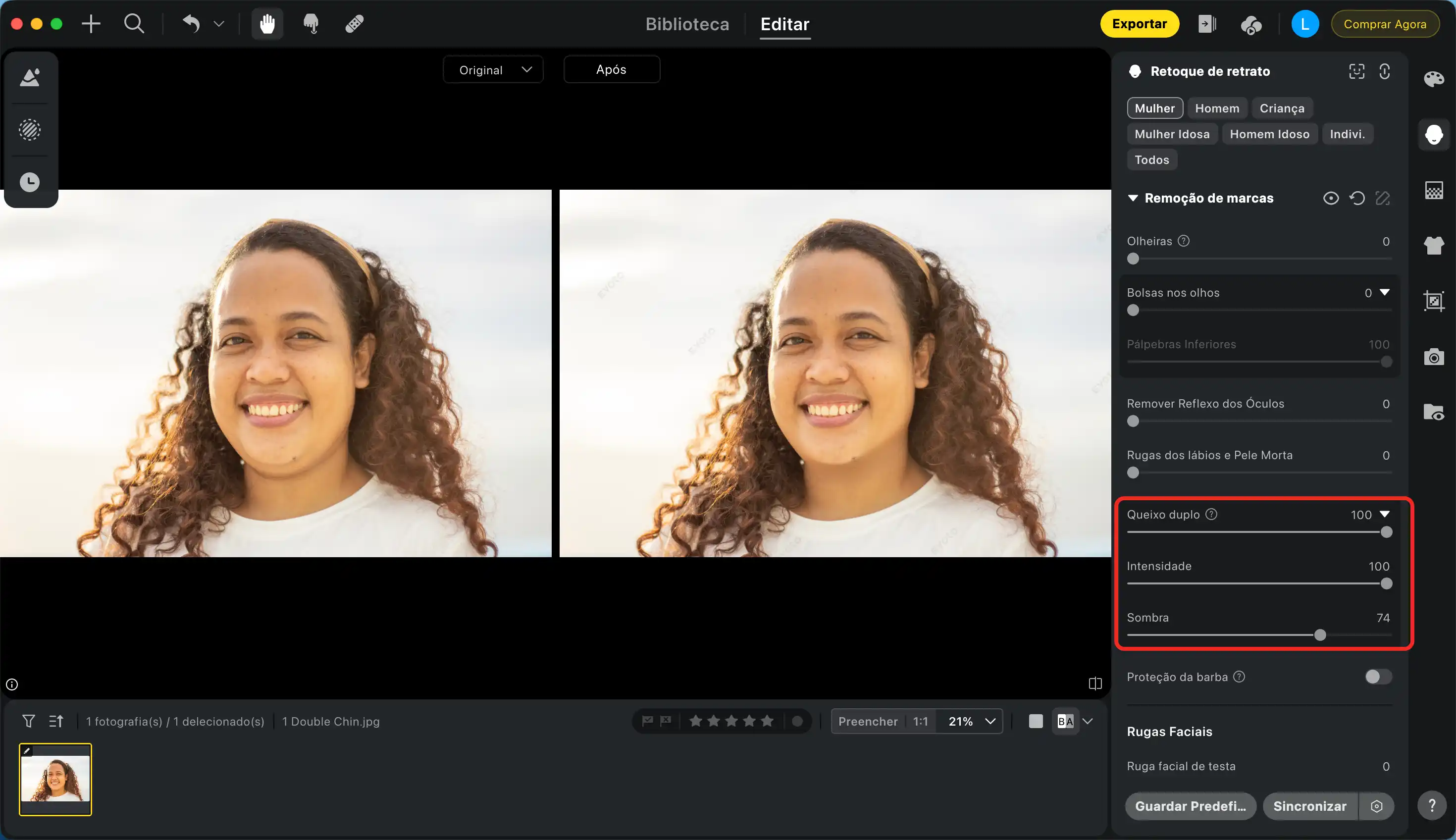 Ajuste e Remova a Papada