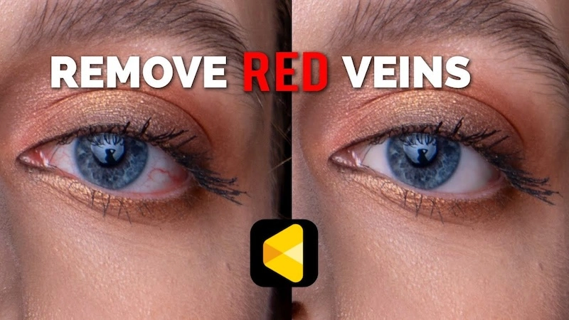 Remove Red Veins Eyes Photo