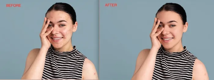 AI Skin Retouching Before and After