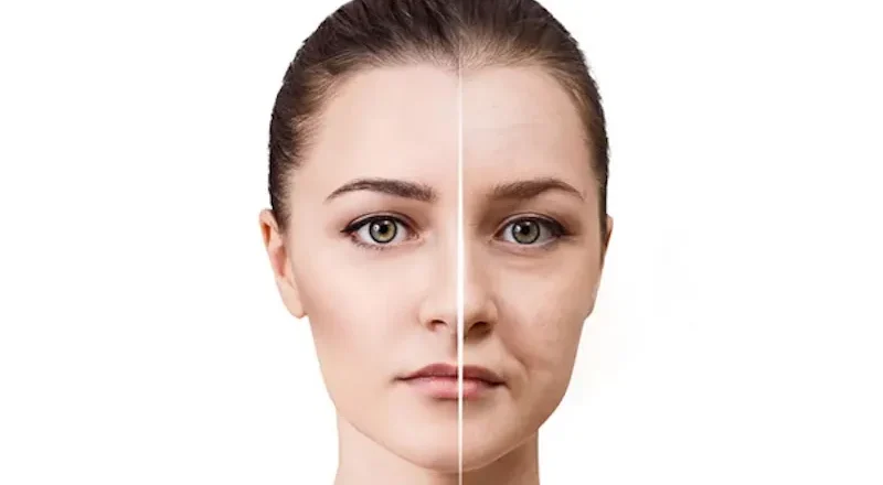 Remove Eye Wrinkles from Photo e1755770670183