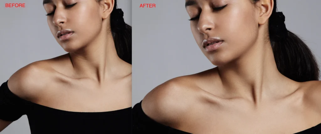 Remove Wrinkles in Neck Effect