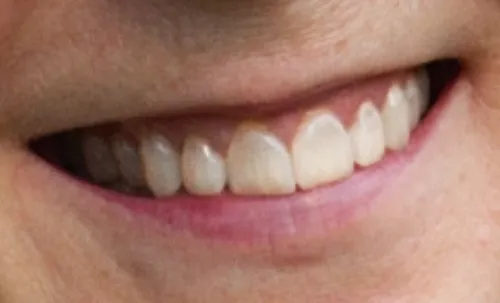 Black Friday Portrati Teeth Retouching After