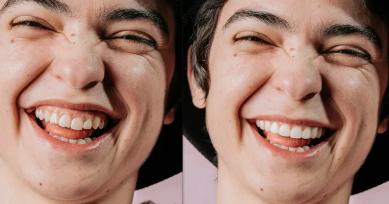 Evoto AI Perfect Teeth Filter for Photo Online