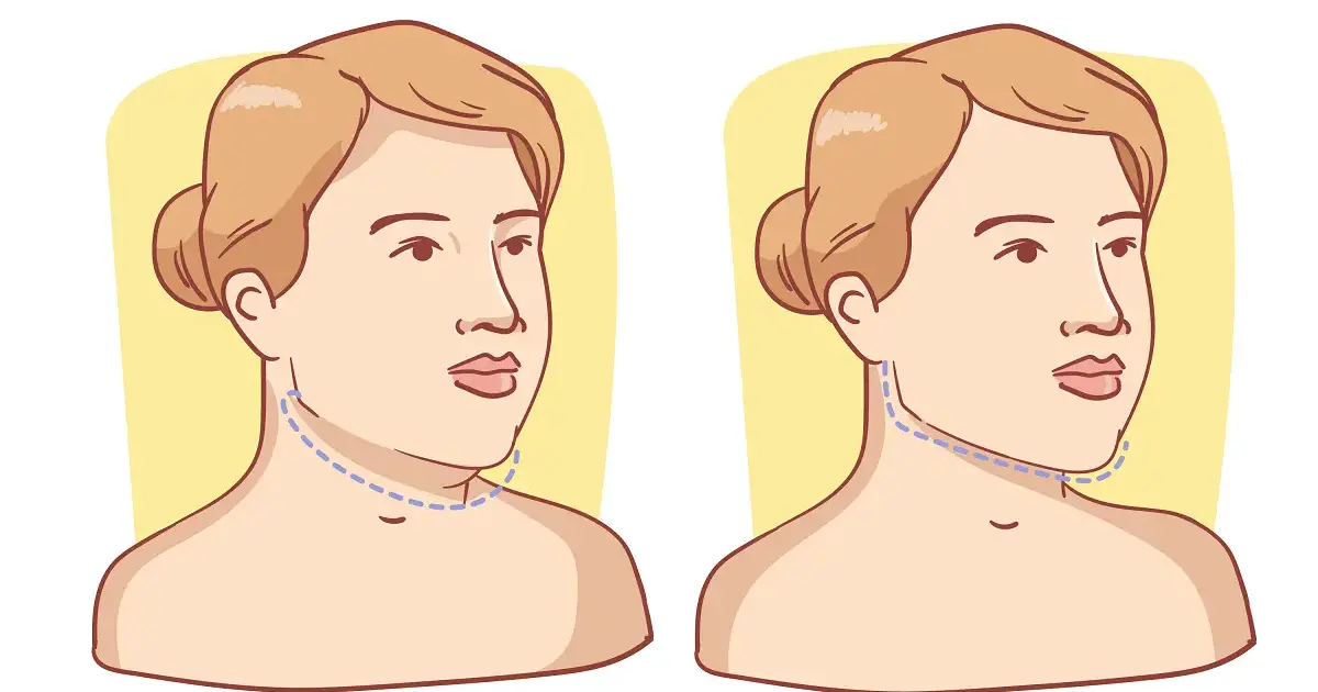 How to Lose Face Fat in Photos