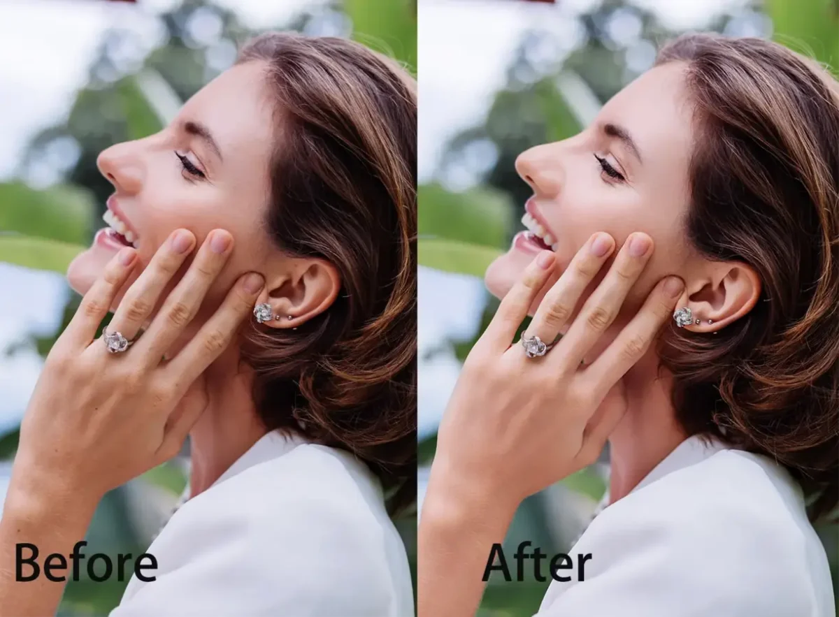 Hand Rejuvenation Before and After