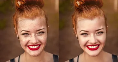 Remove Spots from Photo with Evoto AI