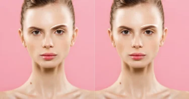 How to Fix Asymmetrical Face in Photos