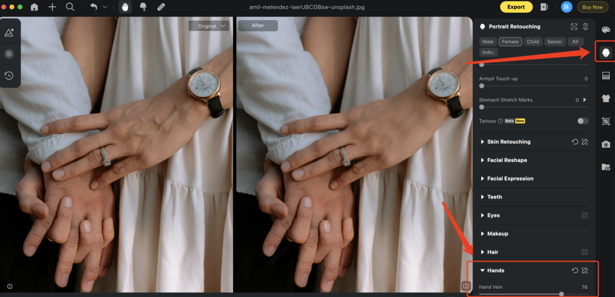 image 1 Upload your photo and apply hand rejuvenation