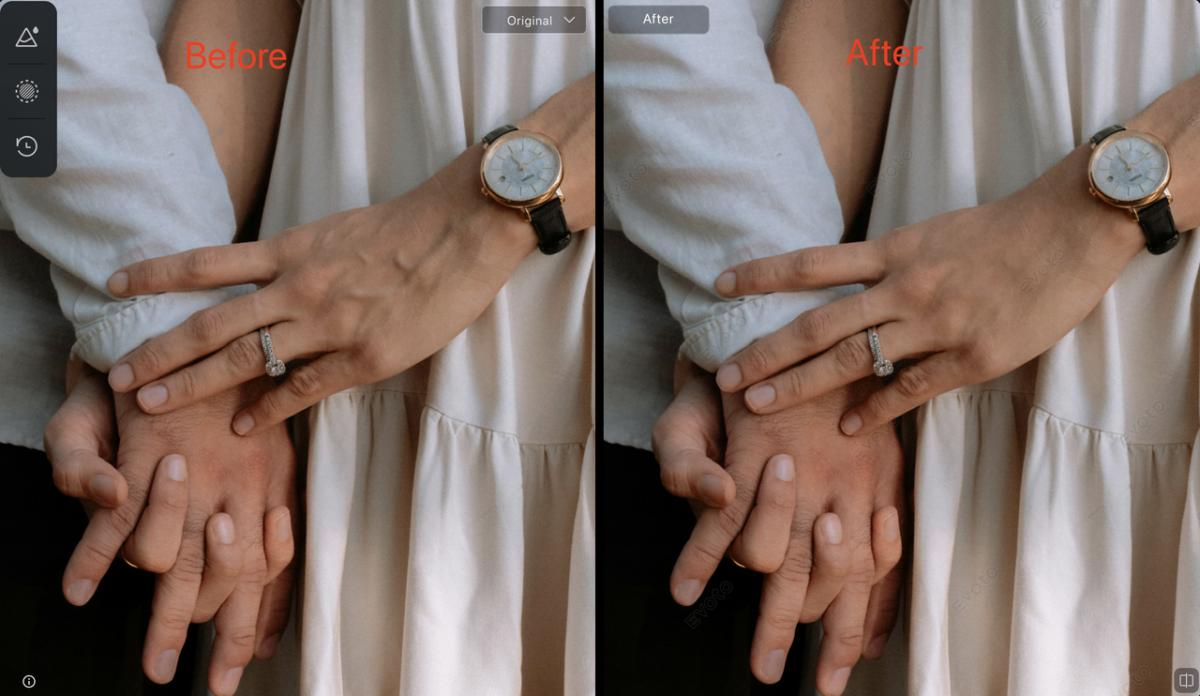 image How Evoto AI Hand Rejuvenation Feature Works