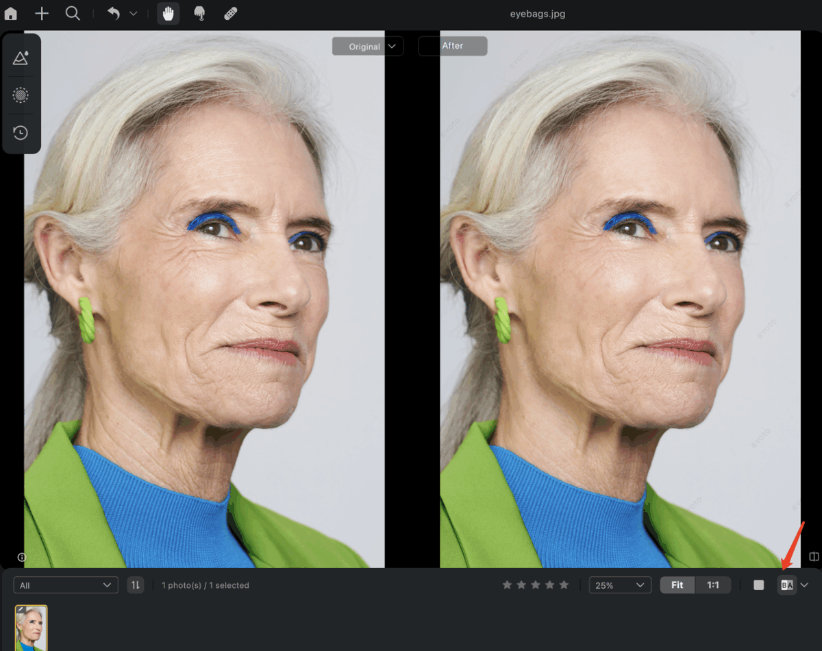 8 Before & After Wrinkles Removal