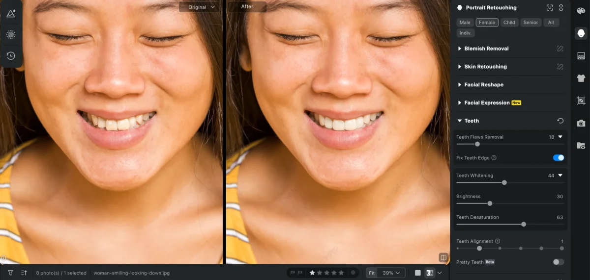 AI teeth corrector AI Teeth corrector