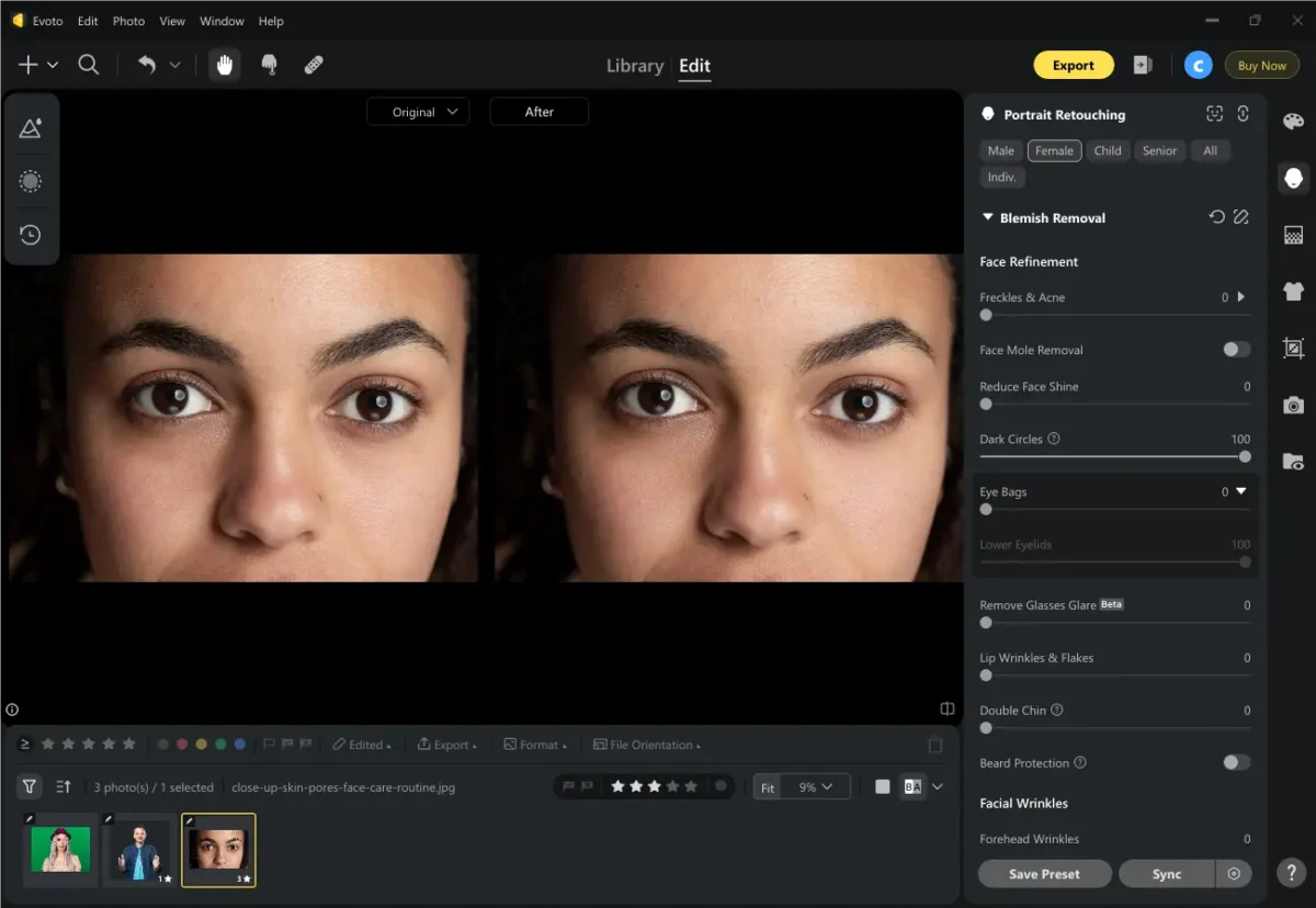 Remove Dark Circles in Photo with Evoto