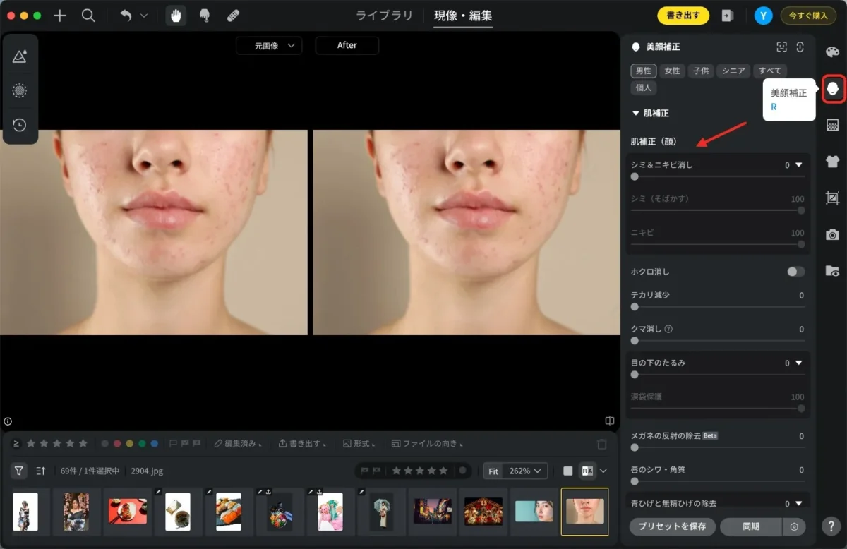 evoto 肌補正 ニキビ消し