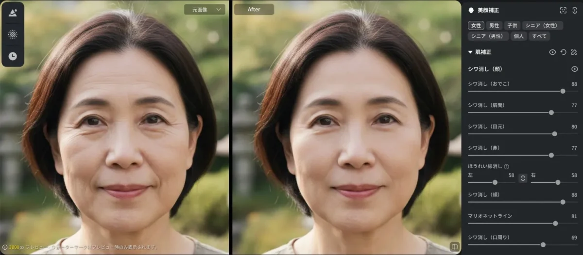 evoto ほうれい線消し