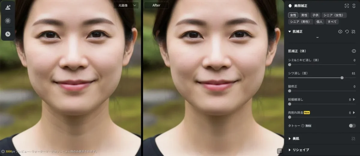 evoto 首のシワ消し