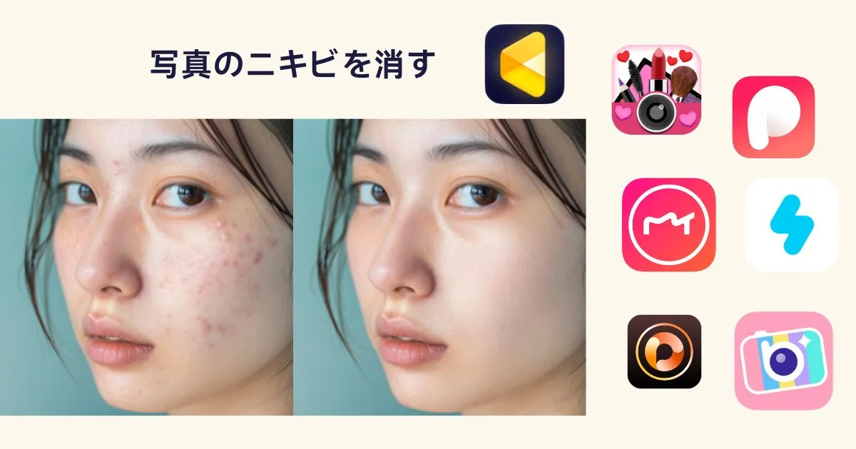 写真 ニキビ 消す