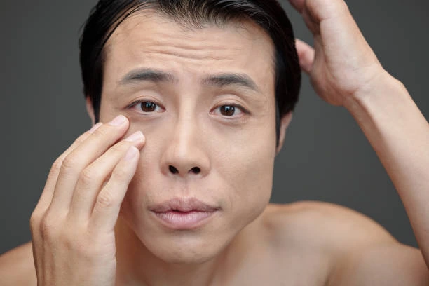 remove forehead wrinkles before おでこのシワ消し前に