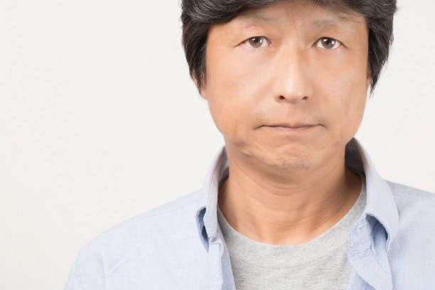 remove nasolabial fold after ほうれい線消し後