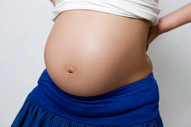remove pregnancy line after 妊娠線消し後