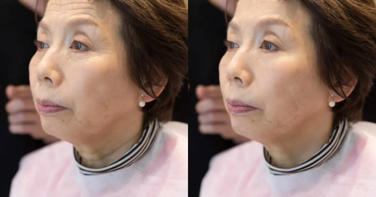 写真のシワ消し