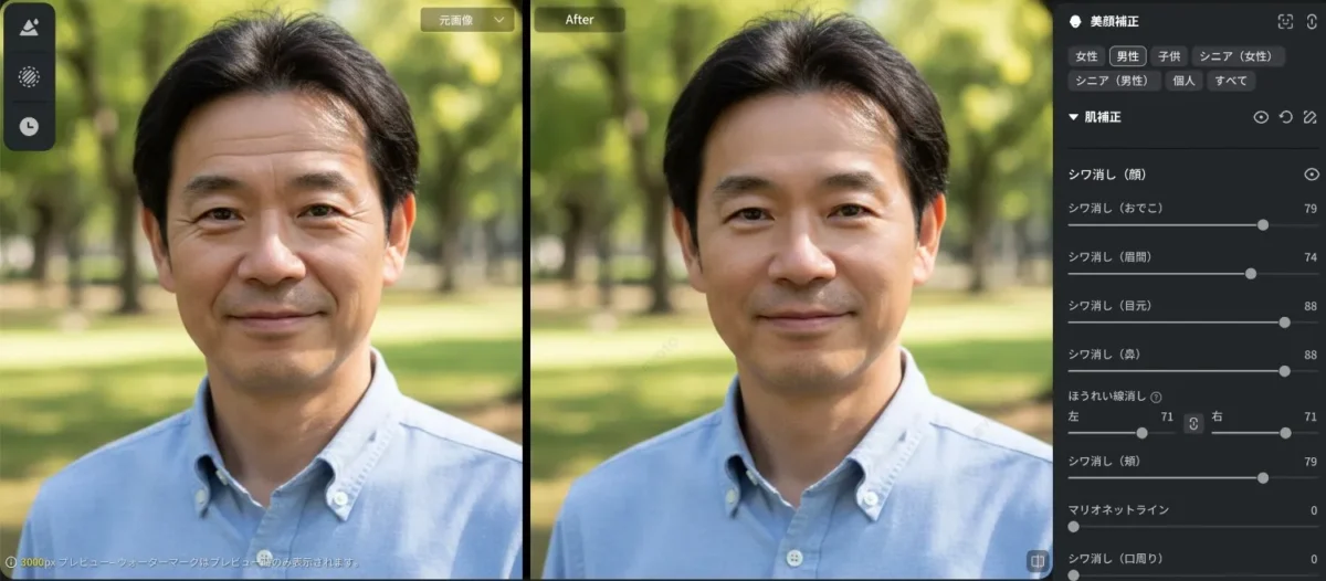 evoto 顔のシワ消し