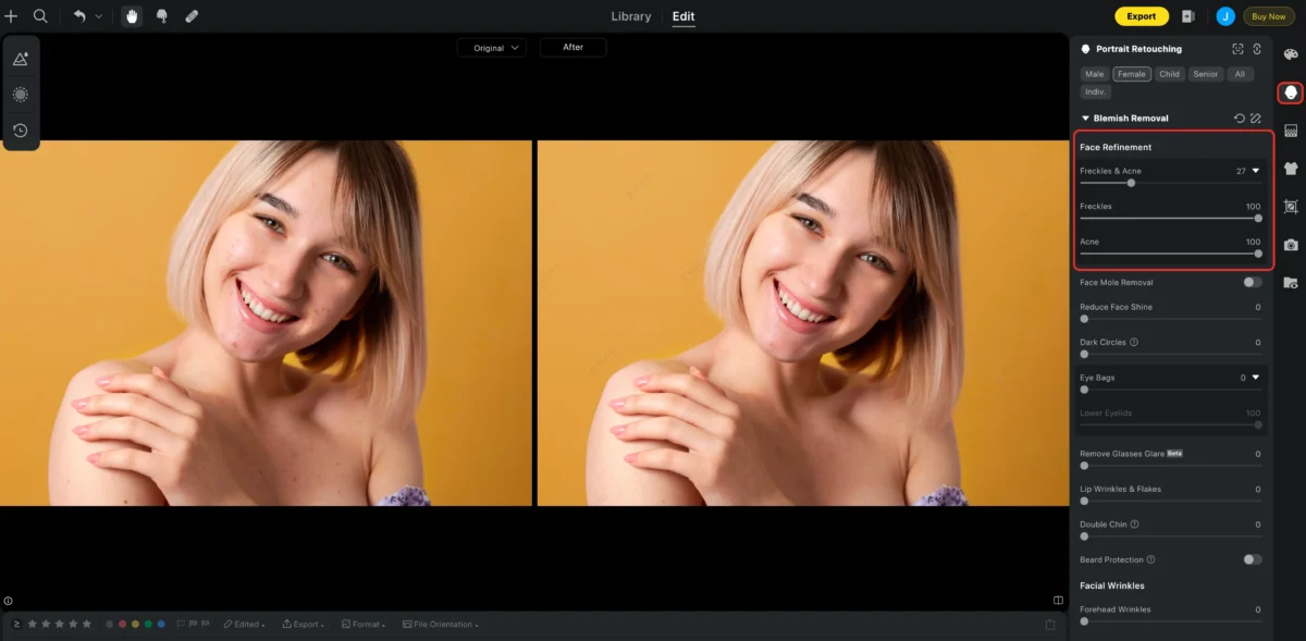 A7756839 A244 416E 9315 038EB7B71594 1 blemish remover