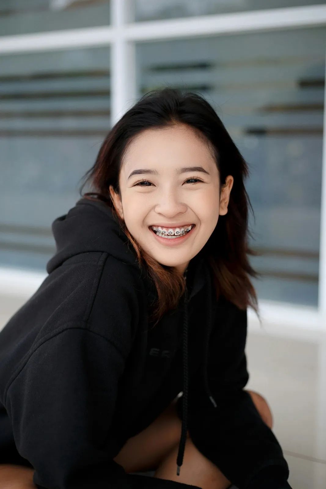 before teeth flaws removal 歯の不要物除去前の状態