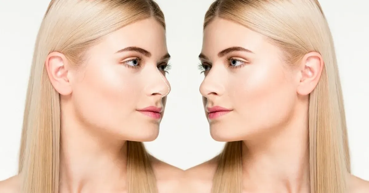 How to Fix Facial Asymmetry