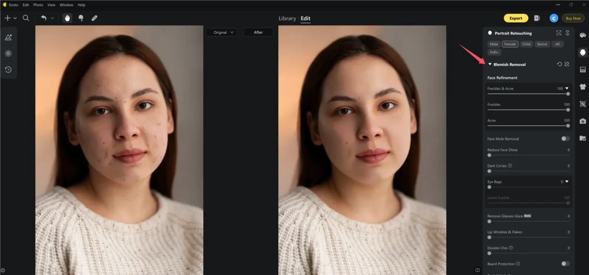 Remove Blemish from Photo Remove Blemish from Photo