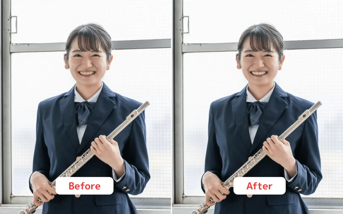 evoto teeth whitening before after