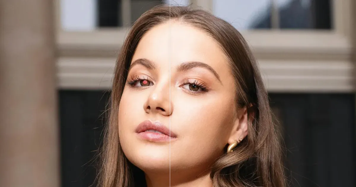 red eye removal
