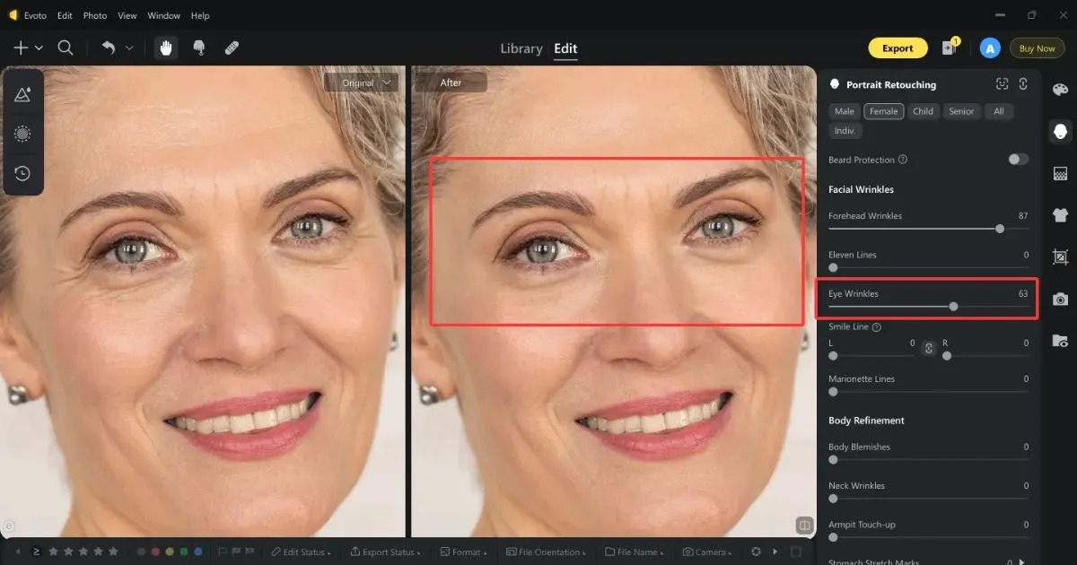 remove eye winkles