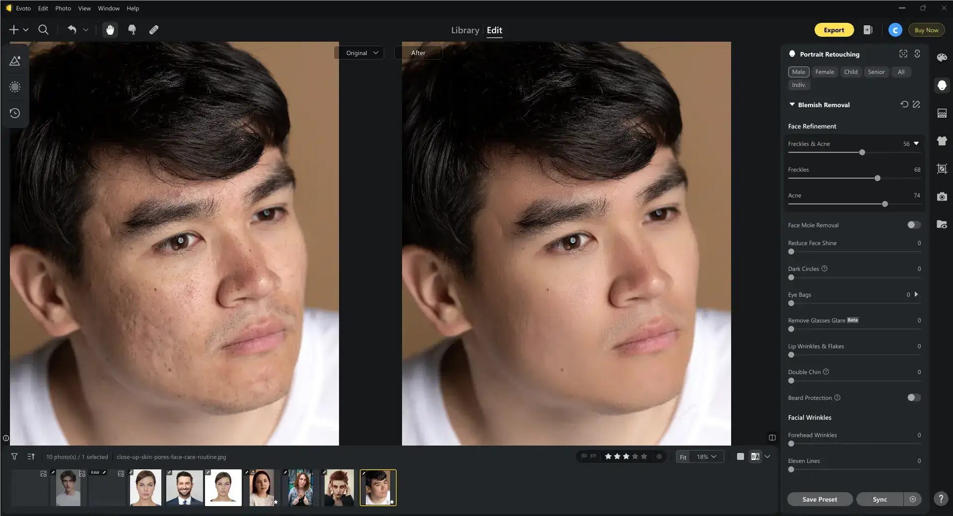 Remove Blemish in Photo with Evoto 1 Remove Blemish in Photo with Evoto