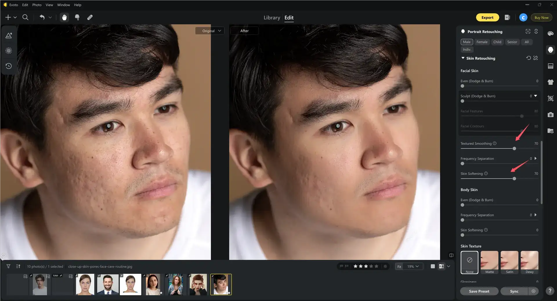 Smooth Skin with Evoto 1 Smooth Skin with Evoto