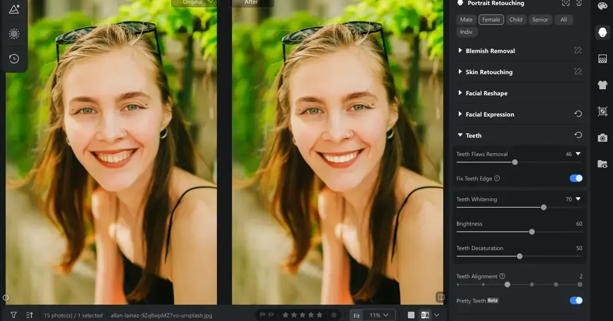Teeth Whitening Photo Editor