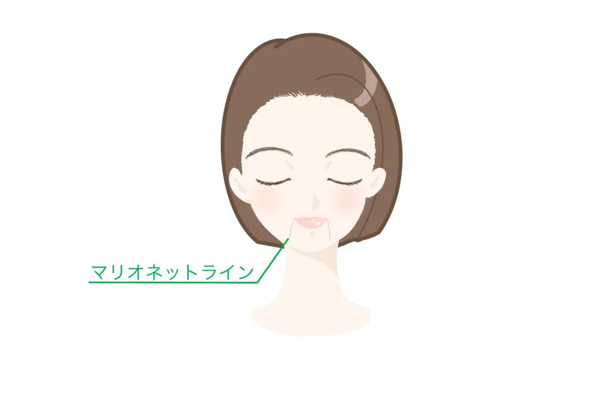 マリオネットライン