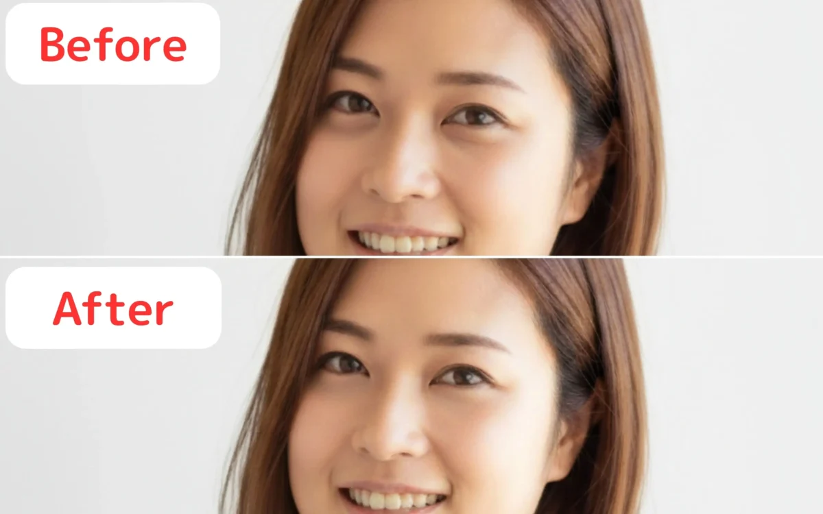 目の下のクマが消えて自然に明るい印象になったBefore/After比較