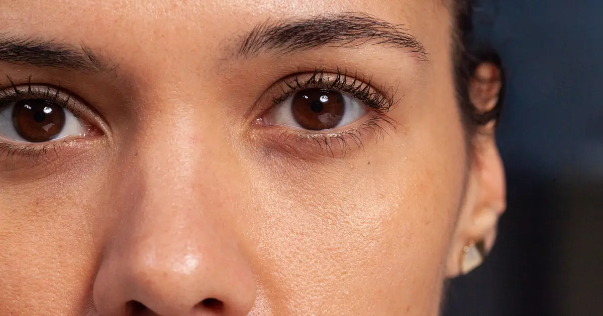 Como Tirar Olheiras da Foto