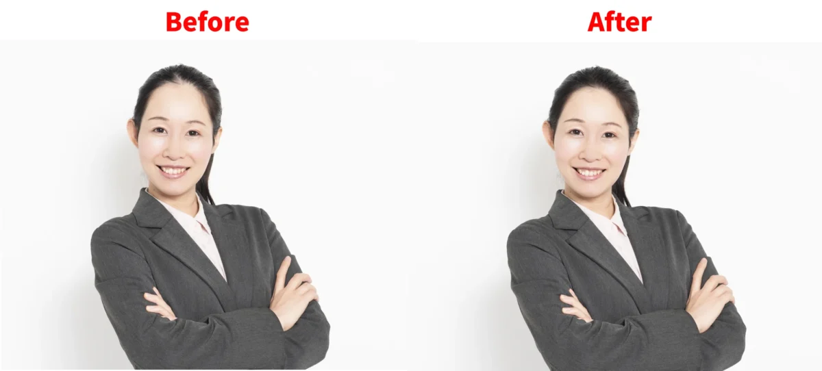 後退した生え際補正前後の比較画像