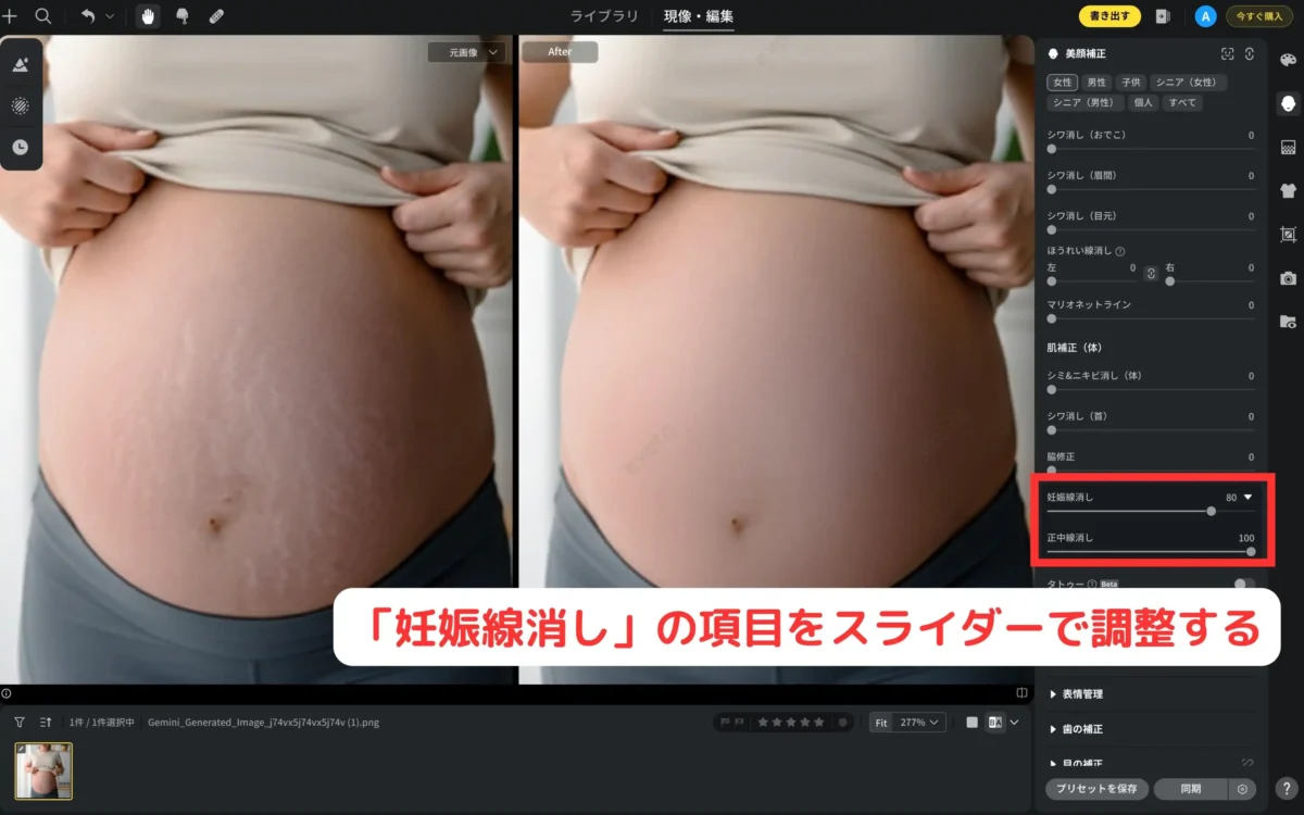 妊娠線消しのスライダーを操作する