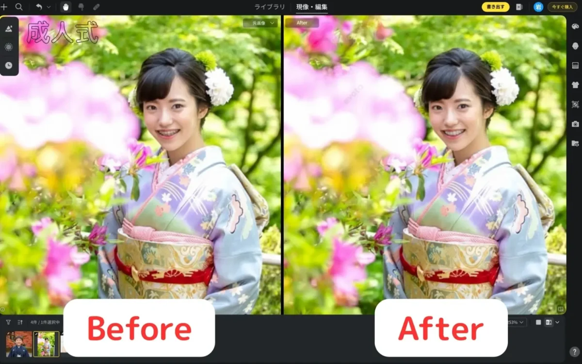 成人式の振袖姿で矯正器具が消えたBeforeとAfterを並べた比較画像