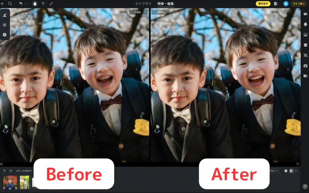 学校での写真で矯正器具が消えたBeforeとAfterを並べた比較画像