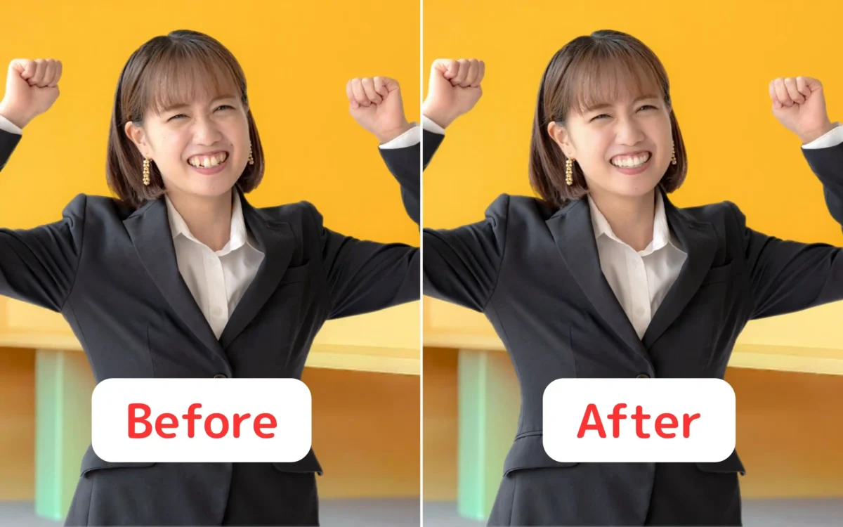 Evoto AIで歯並びを整えたBeforeAfter画像