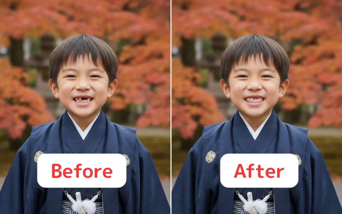 Evoto AIでかけた歯を修復したBeforeAfter画像