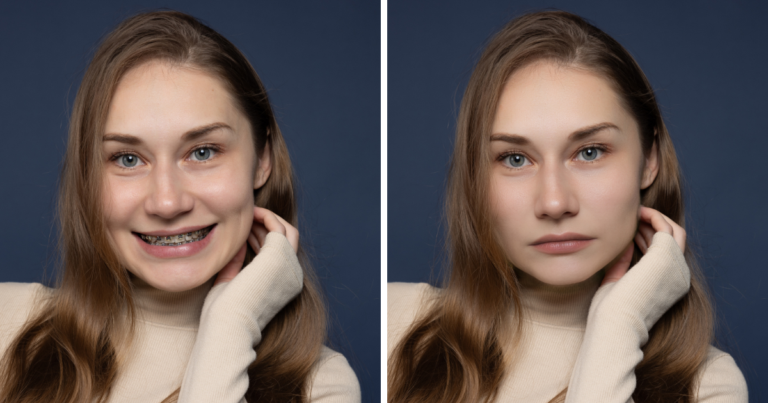 close mouth in photo before and after