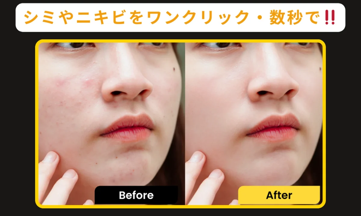 Evotoで実現するシミやニキビ消し ビフォー・アフター比較