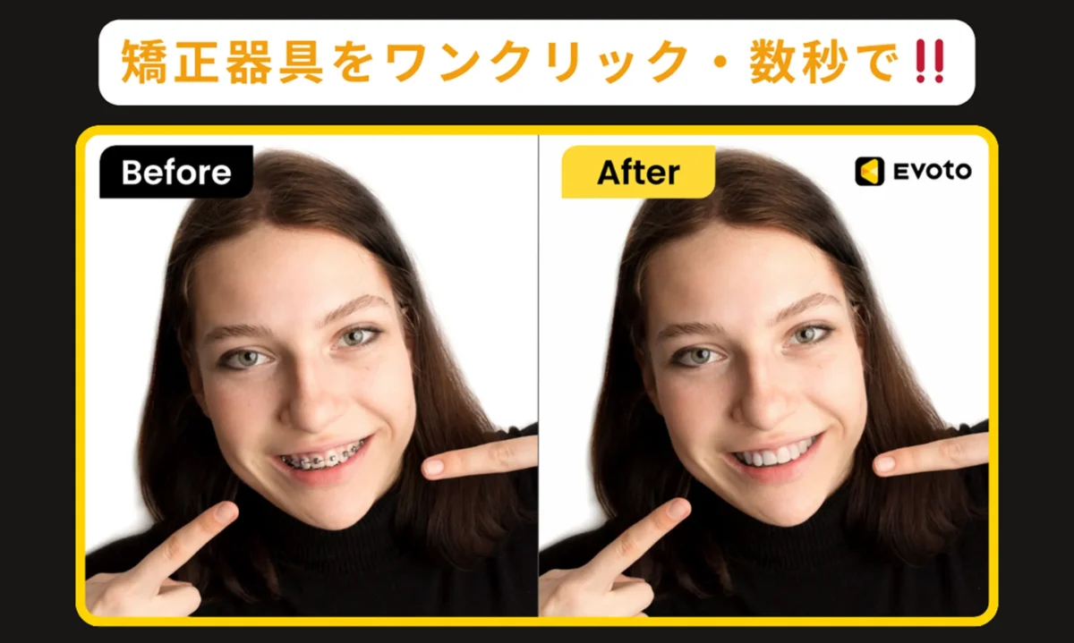 Evotoで実現する歯の矯正器具除去 ビフォー・アフター比較