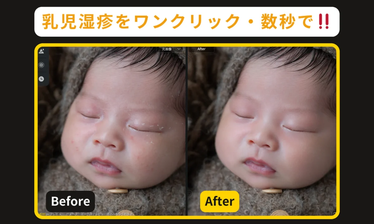 Evotoで実現する赤ちゃんの肌レタッチ ビフォー・アフター比較