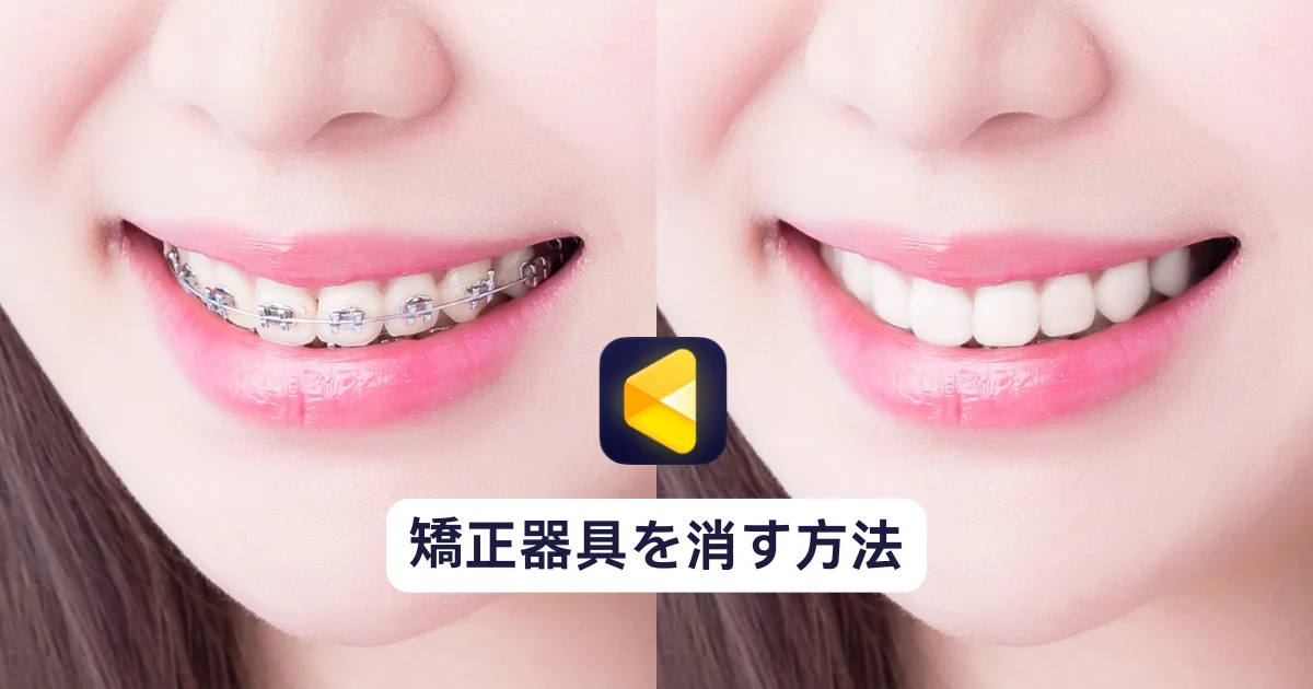 写真から歯の矯正器具を自然に消す方法｜プロ向け／自然な仕上がり｜Evoto